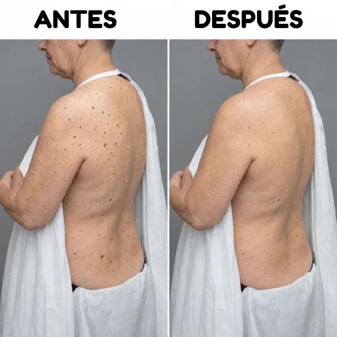 Oname | Barra corporal de ácido glicólico suave y uniforme