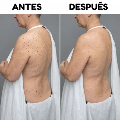 Oname | Barra corporal de ácido glicólico suave y uniforme