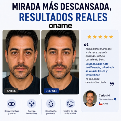 Oname™ - Parches Micropuntos Revitalizantes