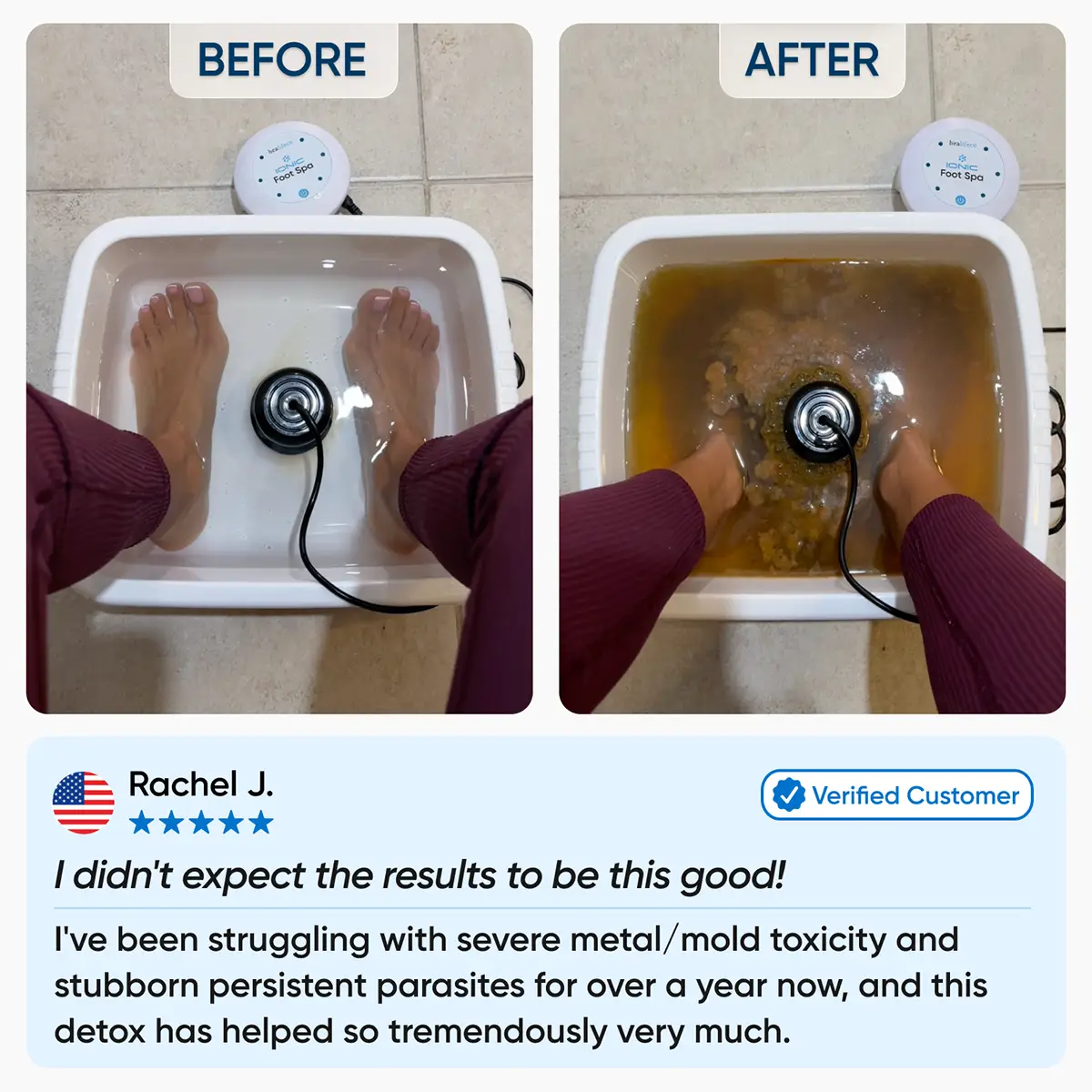 Oname | Ionic Foot Spa