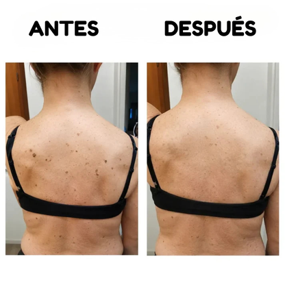 Oname | Barra corporal de ácido glicólico suave y uniforme