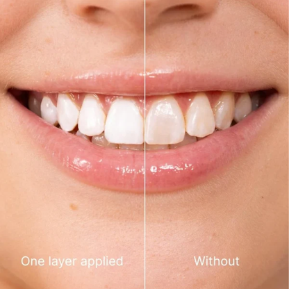 Oname® Esmalte Dental Blanqueador
