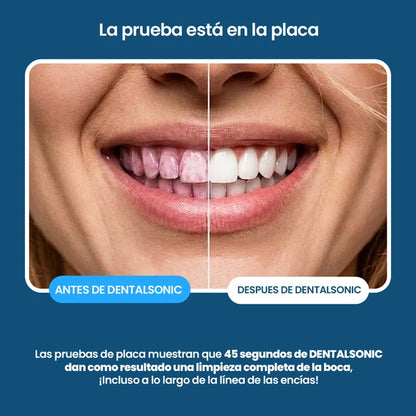 Cepillo Dental Sonic 360° Ultrasónico Blanqueador