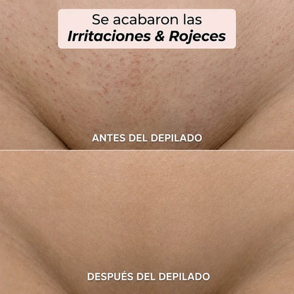 Depiladora Oname® - Olvidate del dolor al depilar