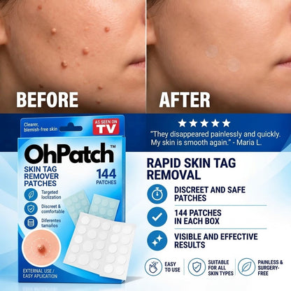 Ohpatch - Patches for Removing Skin Warts