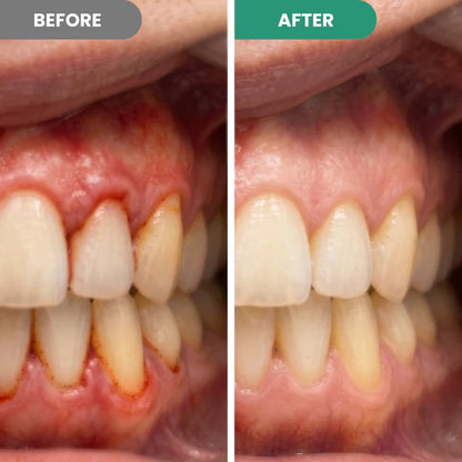 Oname | Teeth Repair Pen