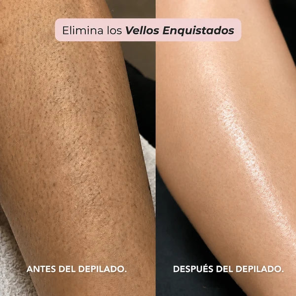 Depiladora Oname® - Olvidate del dolor al depilar
