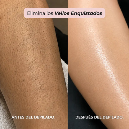 Depiladora Oname® - Olvidate del dolor al depilar