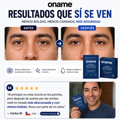 Oname™ - Parches Micropuntos Revitalizantes