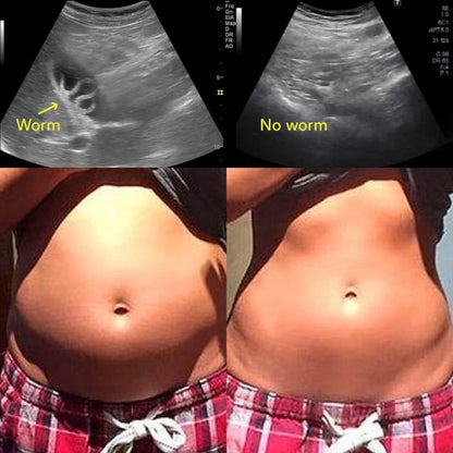 Ultimate Full-Body Cleanse for Parasites, Metals & Microplastics