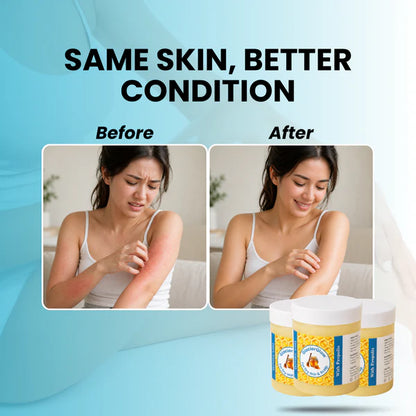 GlacierSkin - Repair Balm For Eczema & Psoriasis