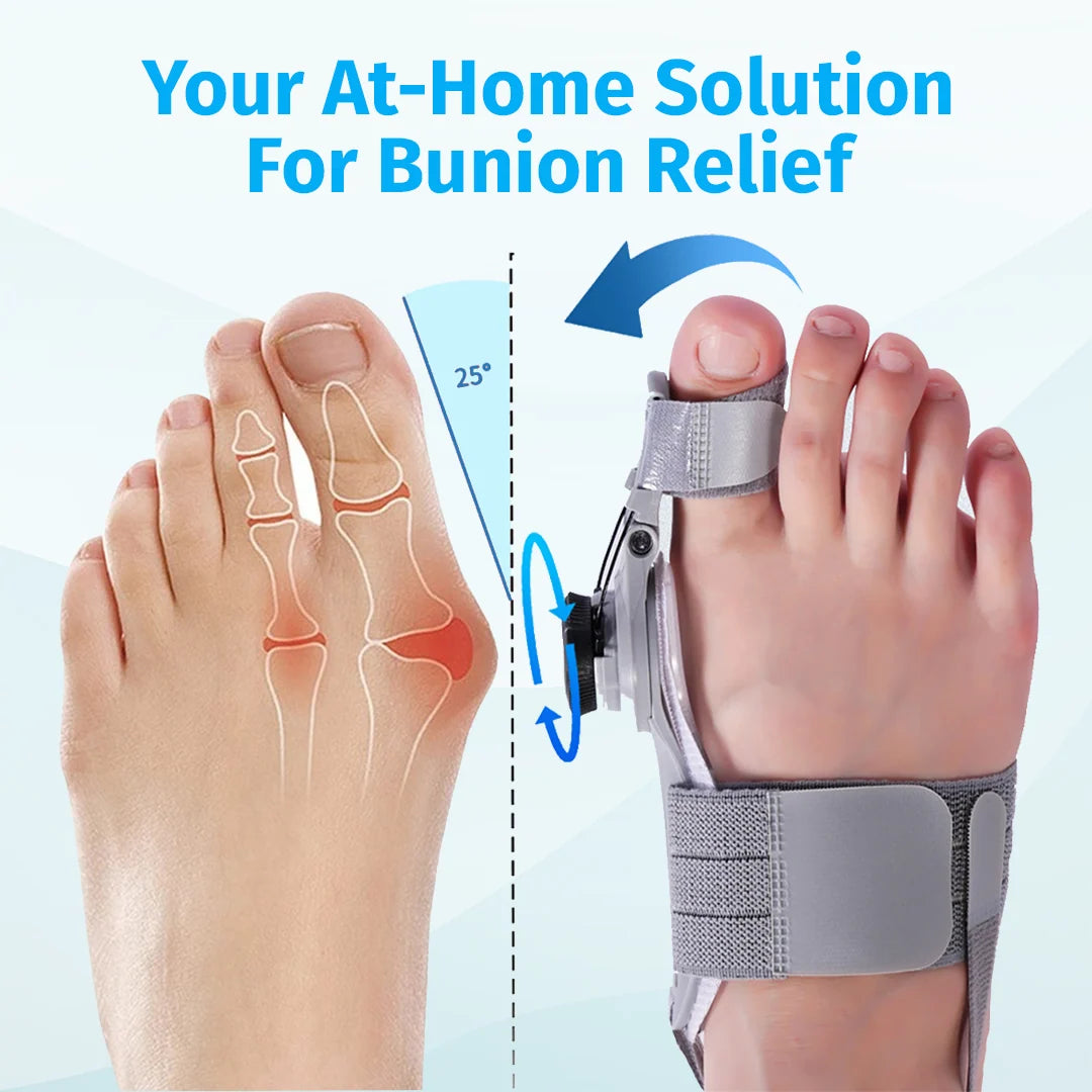 Oname™ Bunion Fix