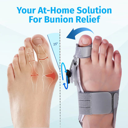 Oname™ Bunion Fix