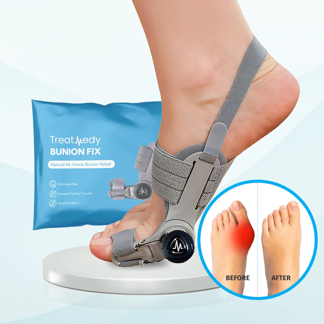 Oname™ Bunion Fix