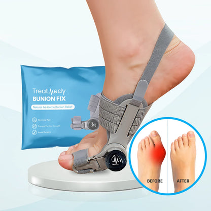 Oname™ Bunion Fix