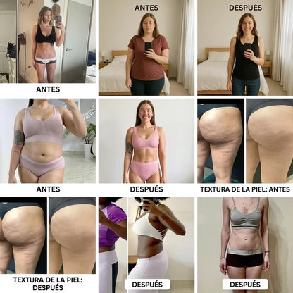 Lipo Lift – Crema Reafirmante Intensiva