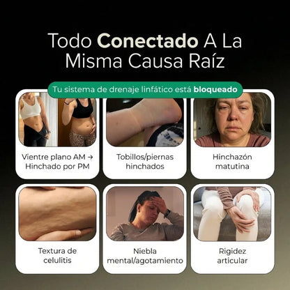 Nueva Fórmula de Máxima Potencia – Cápsulas de Drenaje Linfático