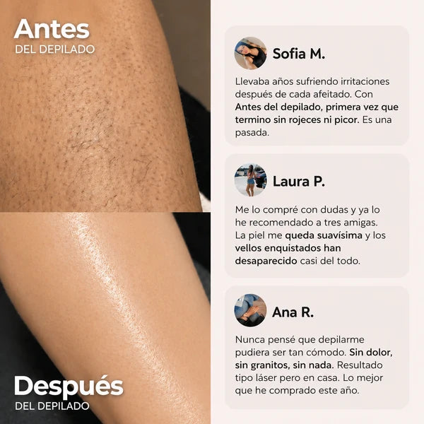 Depiladora Oname® - Olvidate del dolor al depilar