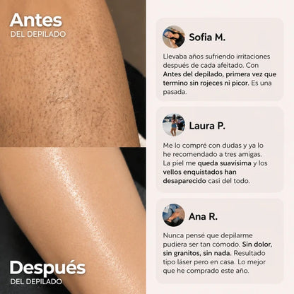 Depiladora Oname® - Olvidate del dolor al depilar
