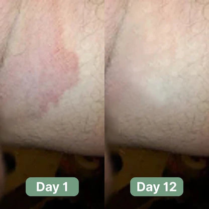 Oname Antifungal Soap®
