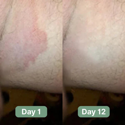 Oname Antifungal Soap®