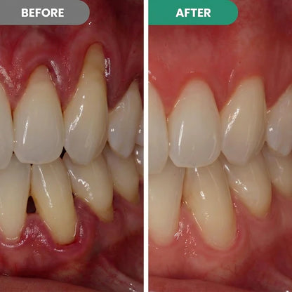 Oname | Teeth Repair Pen