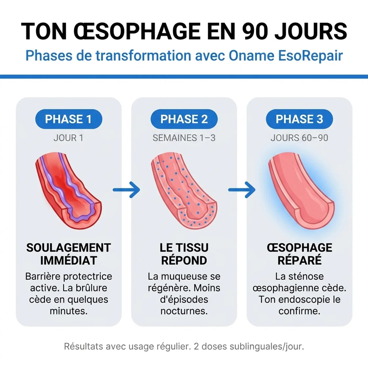 Oname EsoRepair™ | Réparateur œsophagien nano-sublingual